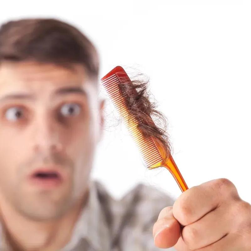 Notre enquête sur la chute de cheveux : un enjeu majeur pour les consommateurs